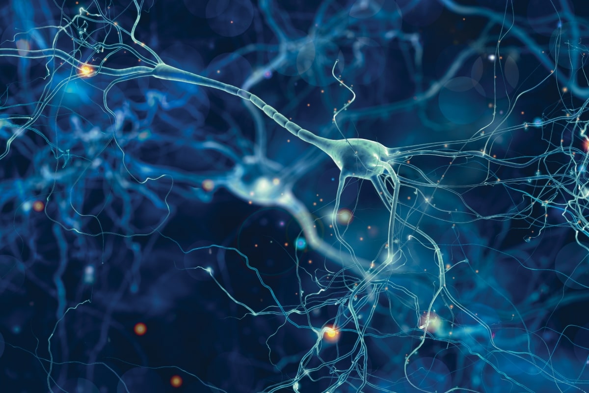 Alzheimer cells